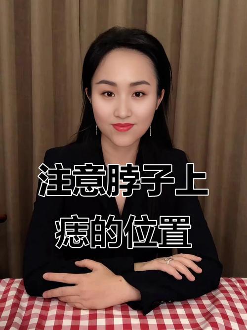 脖子正中間有痣的女人 飛黃騰達為富貴命運