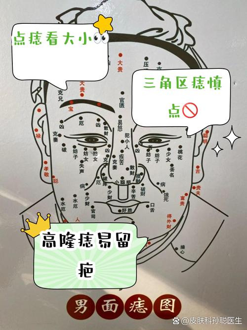 臉上哪些痣不能去掉 五官上的痣不能去