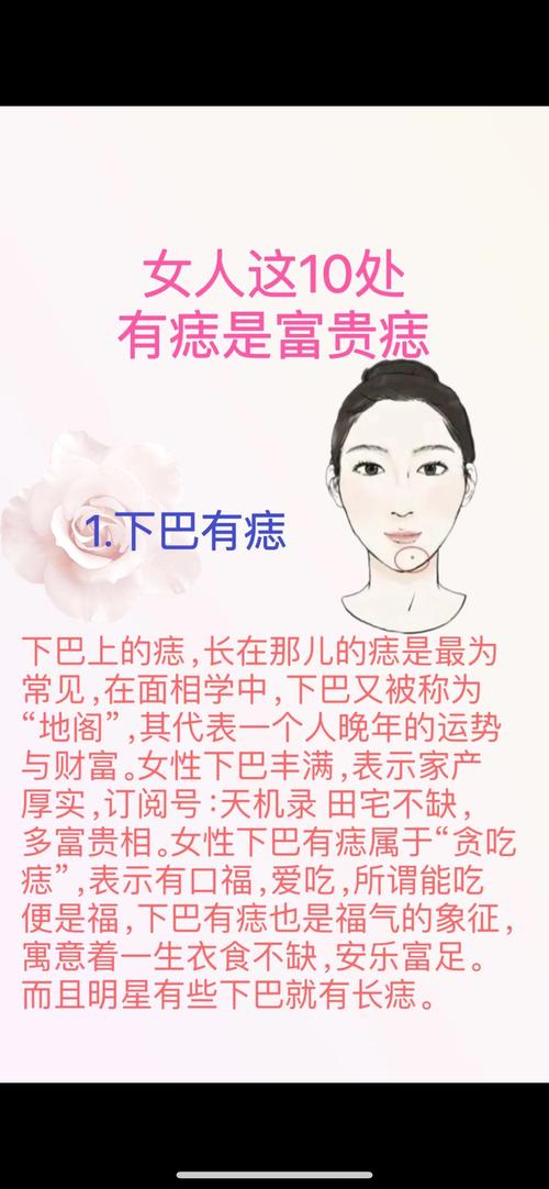 貴子痣有哪些 大吉之相福氣深厚