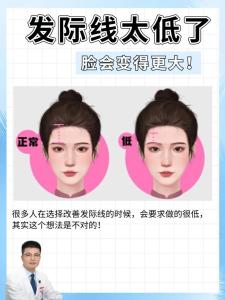 發際線低額頭窄的人是不是很笨,發際線太低了有什么方法改善嗎