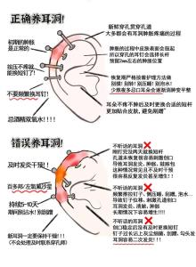 耳洞愈合運(yùn)氣會(huì)回來(lái)嗎
