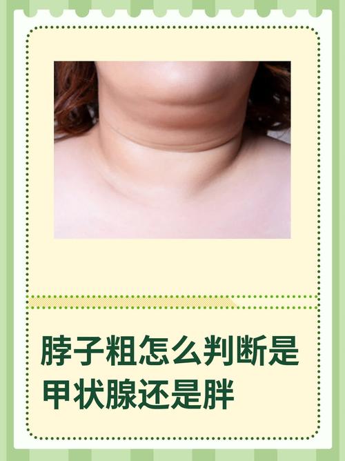 脖子粗的女人命運如何