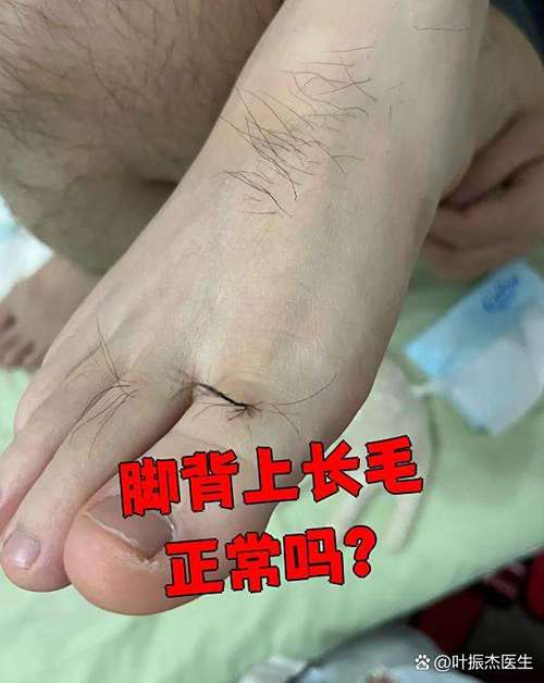 腳背長毛的相學(xué)說法 男的腳背長毛代表什么