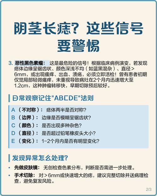 男人龜頭上有痣是代表什么含義 龜頭長(zhǎng)痣什么寓意嗎好不好