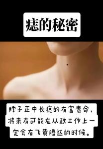 脖子前面有痣的女人 脖子前面有痣的女人命好嗎