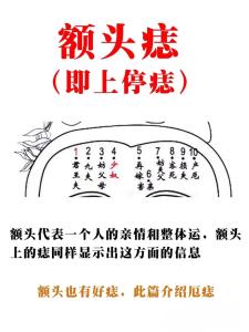 額頭中間有痣,額頭中間長痣代表什么