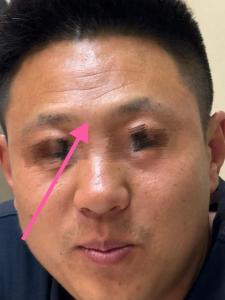 印堂低陷的人克父母是真的嗎