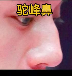 鼻子有節(jié)的男人面相 事業(yè)亨通且節(jié)節(jié)高升