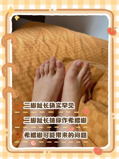 腳二拇指比大拇指長(zhǎng)代表什么 腳趾二拇指比大拇指長(zhǎng)好不好