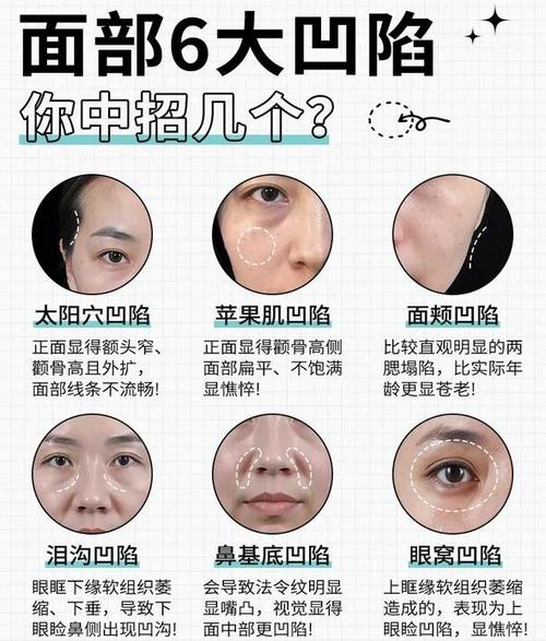 臉上瑕疵預知你近期運勢