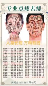 嘴巴左上角有痣的女人好不好 嘴巴左下角有痣女人代表什么