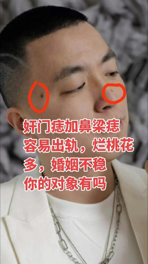 奸門痣會(huì)帶來什么厄運(yùn)嗎