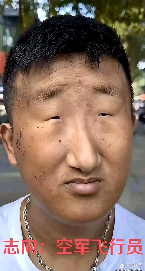 男人的十種貧窮面相 瘦而無神、弓腰駝背