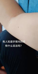 右手胳膊手肘內側有痣 手臂上有長痣的女人代表什么