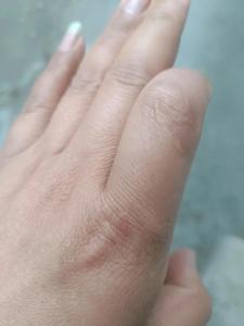 左手食指有疤代表什么 左手食指有疤的傳說