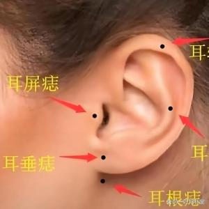 男人耳朵長痣好不好