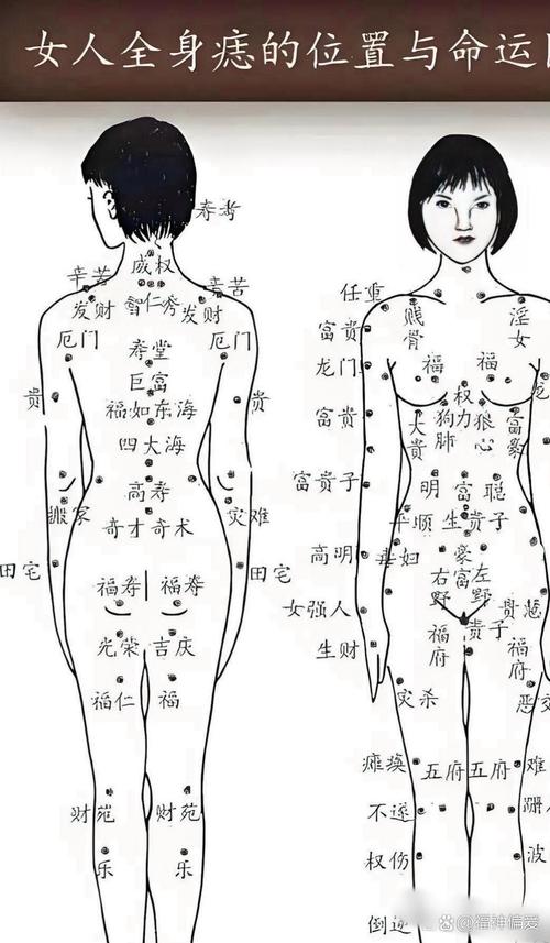 右肩痣的位置圖