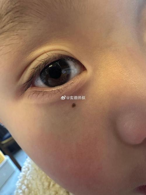 苦情痣和淚痣是一對嗎 淚痣的人注定多淚而苦情痣的人執念很深