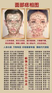 有的痣不能點(diǎn)是真的嗎 嘴巴下的痣可以去掉嗎