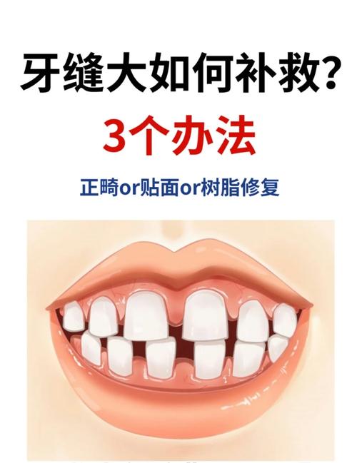 牙齒有縫怎么弄
