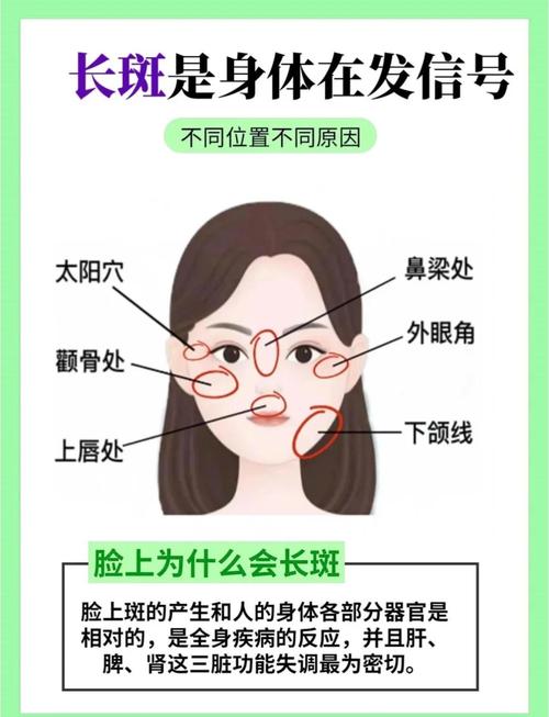 面向解析印堂長斑的原因