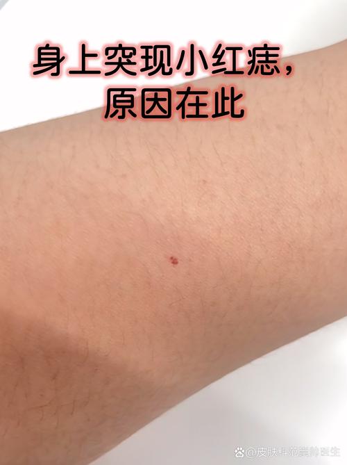 長(zhǎng)朱砂痣好不好