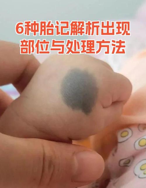 紅胎記算命可不可靠