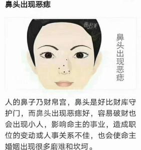 鼻子右側(cè)有痣
