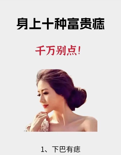 一夜爆發橫財痣 富甲一方的痣