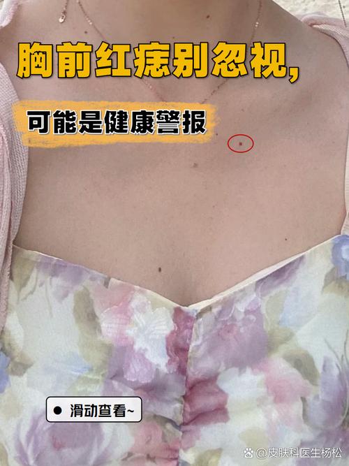 胸口上的痣有什么含義？胸口長痣好不好