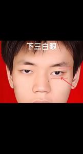 男人下三白眼面相分析 下三白眼的男人的命運好嗎