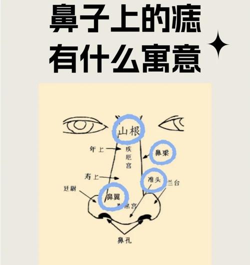 鼻梁上有痣代表著什么