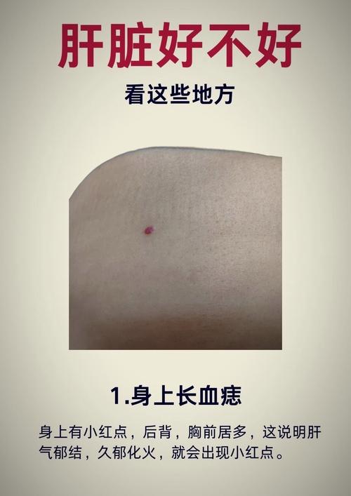 男人身上長(zhǎng)紅痣好不好 身上長(zhǎng)紅痣命理解析