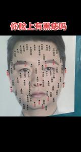 人中有痣的男人好嗎 男人人中長痣代表什么