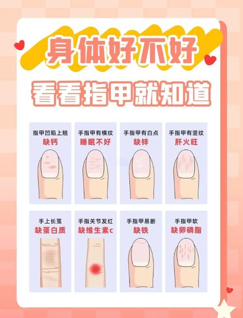 指甲紋路的變化預示著什么