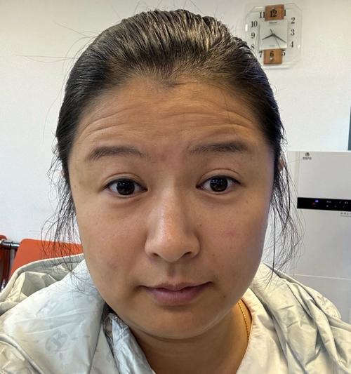 抬頭紋很多的女人命好不好 天生的操勞命