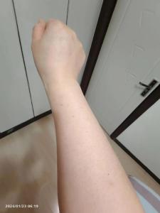 四星連珠痣的預兆