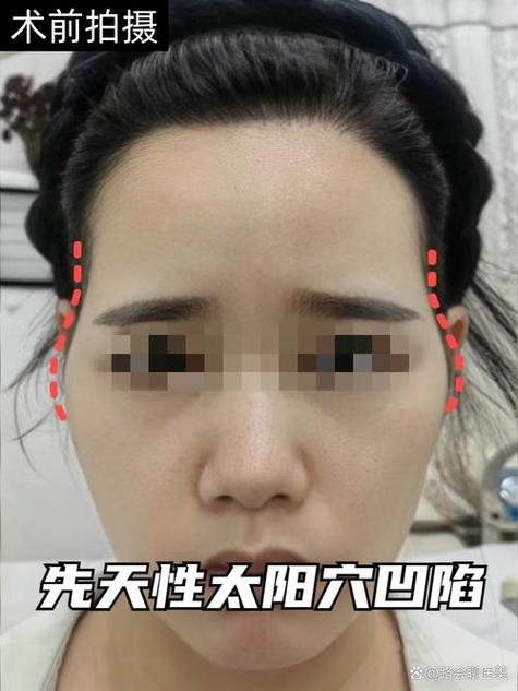 太陽凹陷突然長回來 事業(yè)有望需要把握時機