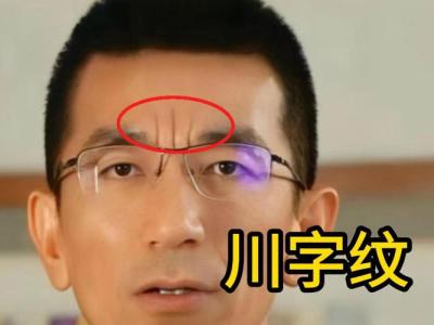 額頭上的川字紋 逢兇化吉工作順心