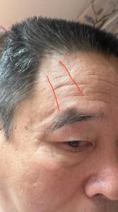 男人額頭上沒有抬頭紋運勢好么