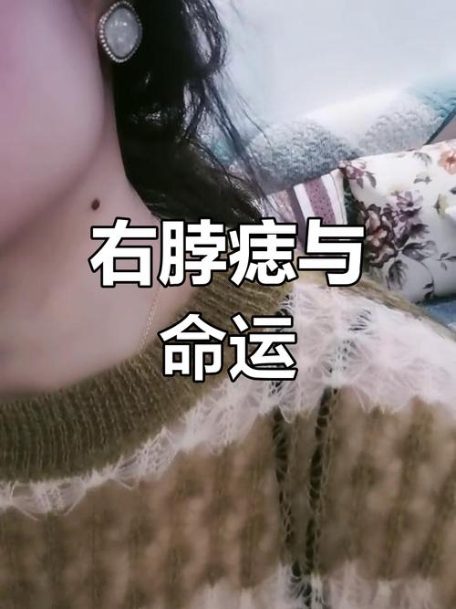 能得老公疼愛的女人痣相 脖子側面有痣旺丈夫財運