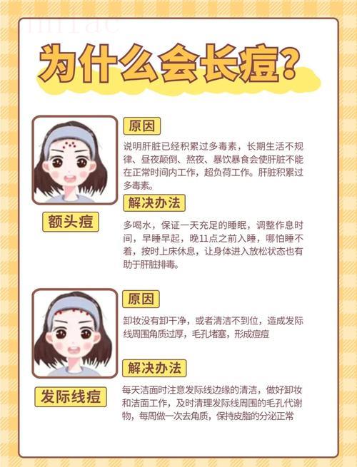 什么命的人容易長(zhǎng)痘 為什么臉上老長(zhǎng)痘痘
