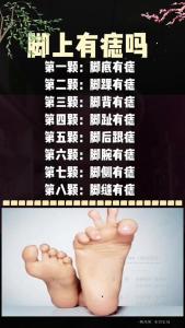 腳踝長痣好不好圖解 腳踝有痣代表什么