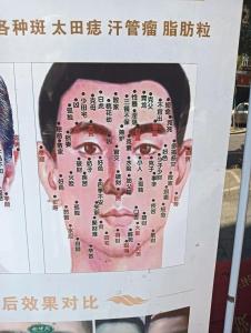 眼睛周?chē)酿胂嗍呛檬菈哪? />
								</a>
								<a href=