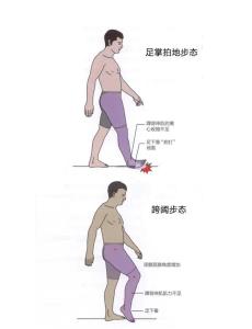 怎么從走路姿勢(shì)看富貴貧窮