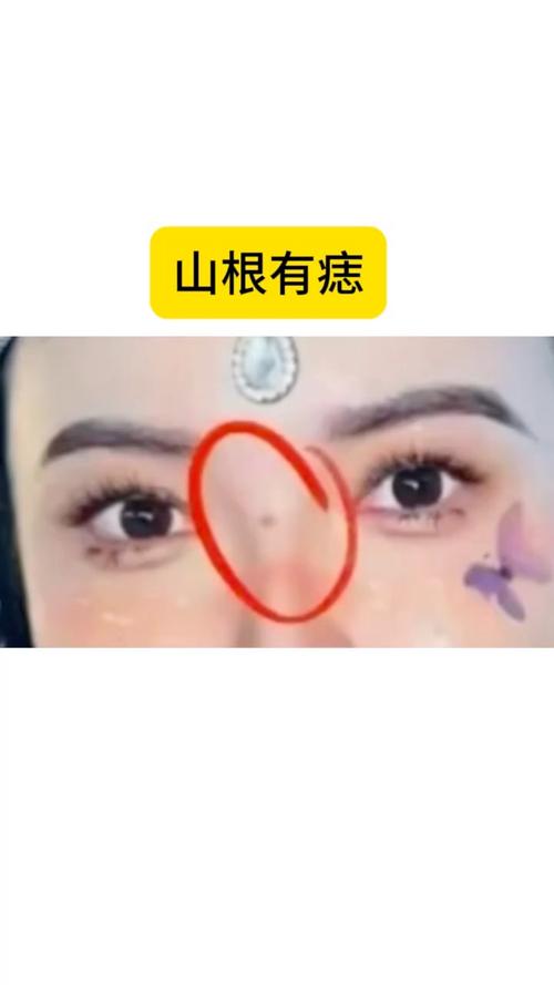 山根有痣影響財運嗎