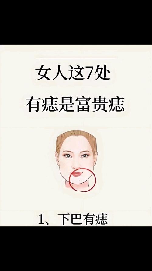 下巴正中間得財痣有哪些特征