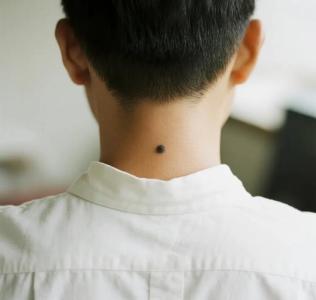 后脖子有痣的男人 命運(yùn)怎么樣