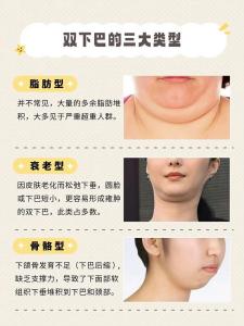 雙下巴是富貴的面相嗎 不胖但有雙下巴的人命運面相怎么樣