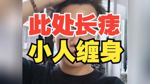 這幾處痣會讓你小人纏身，是非滿天！
